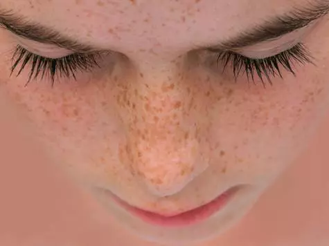 Freckles लावतात कसे?